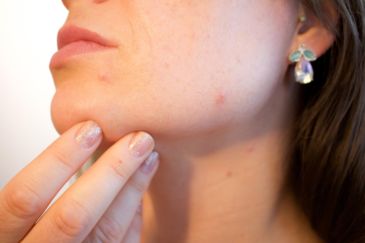 Korean skincare for acne scars Made Simple